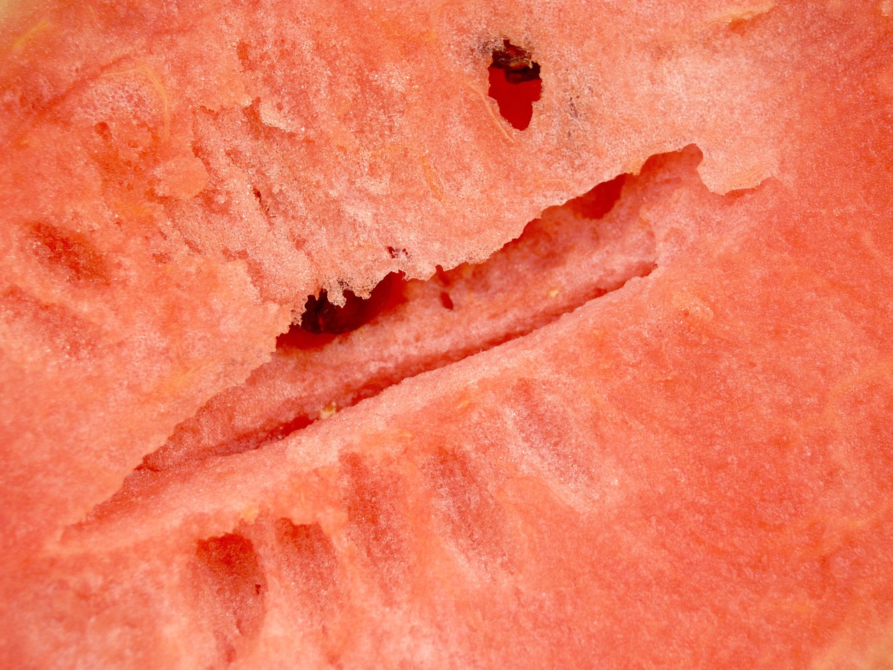 阑尾炎手术后吃什么好？分阶段饮食指南助你轻松恢复，告别术后饮食困扰